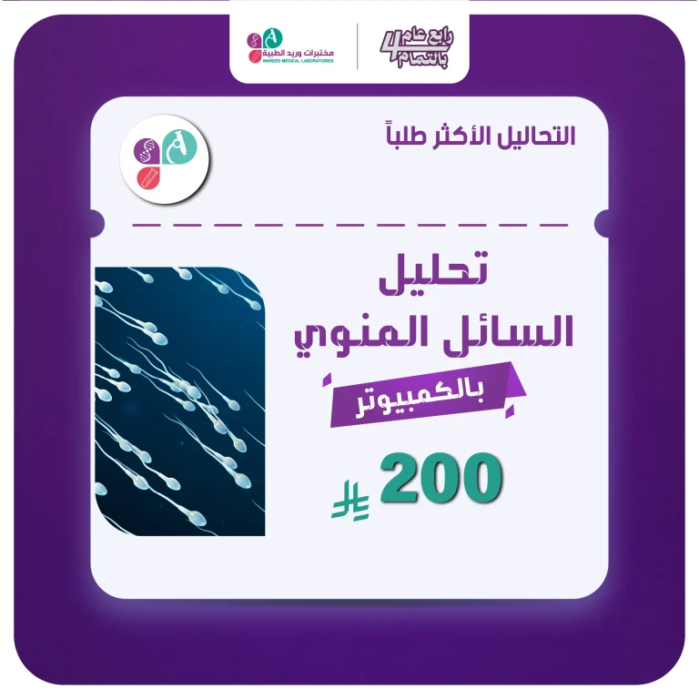 تحليل السائل المنوي
