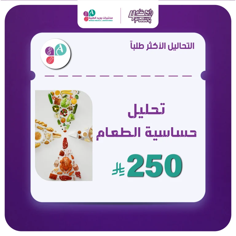 تحليل حساسية الطعام