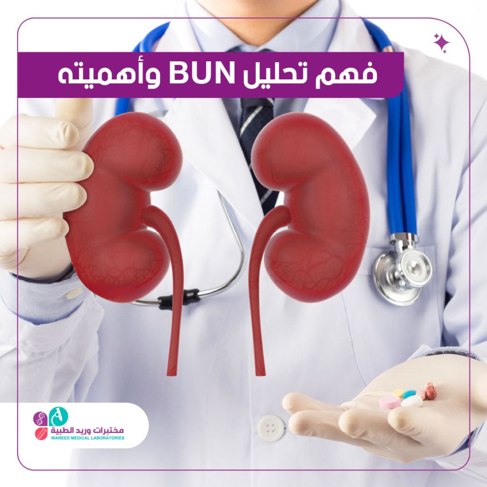 تحليل bun