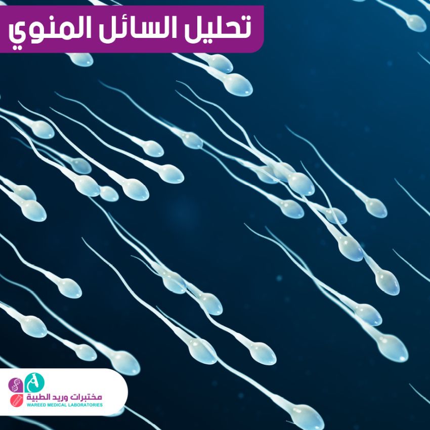 تحليل السائل المنوي