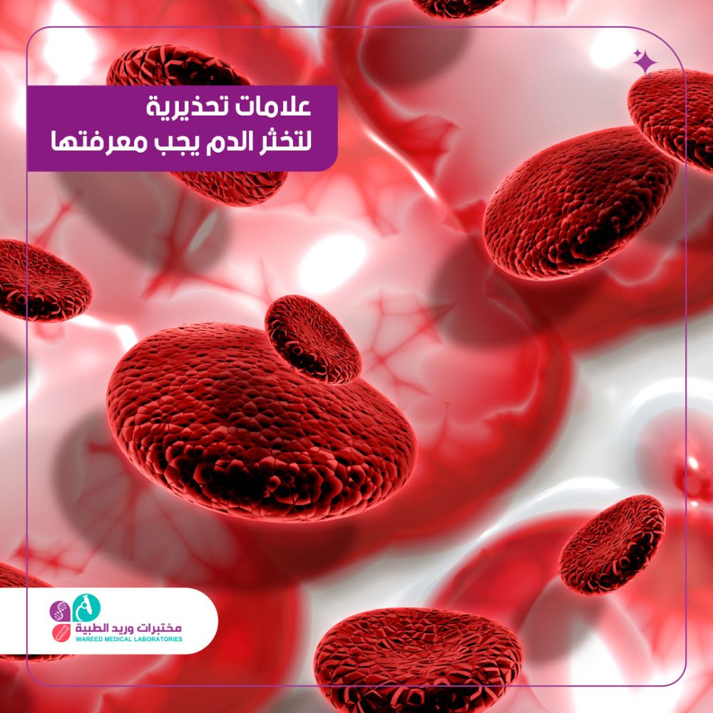 علامات تحذيرية ل تخثر الدم يجب معرفتها