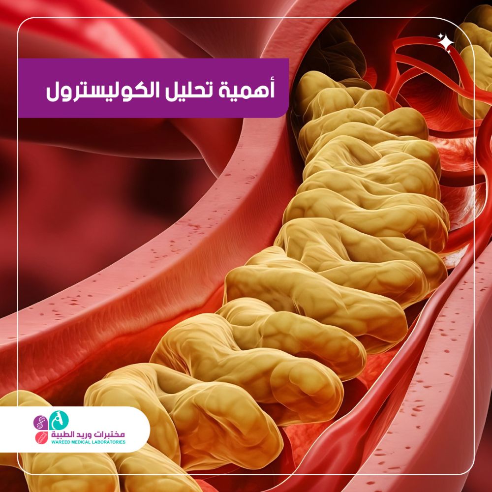 أهمية تحليل الكوليسترول