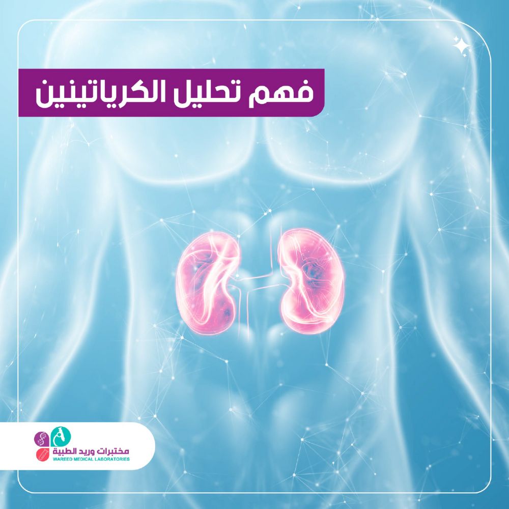 تحليل Creatinine
