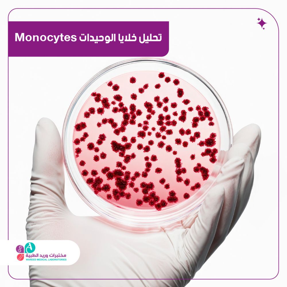 تحليل mono