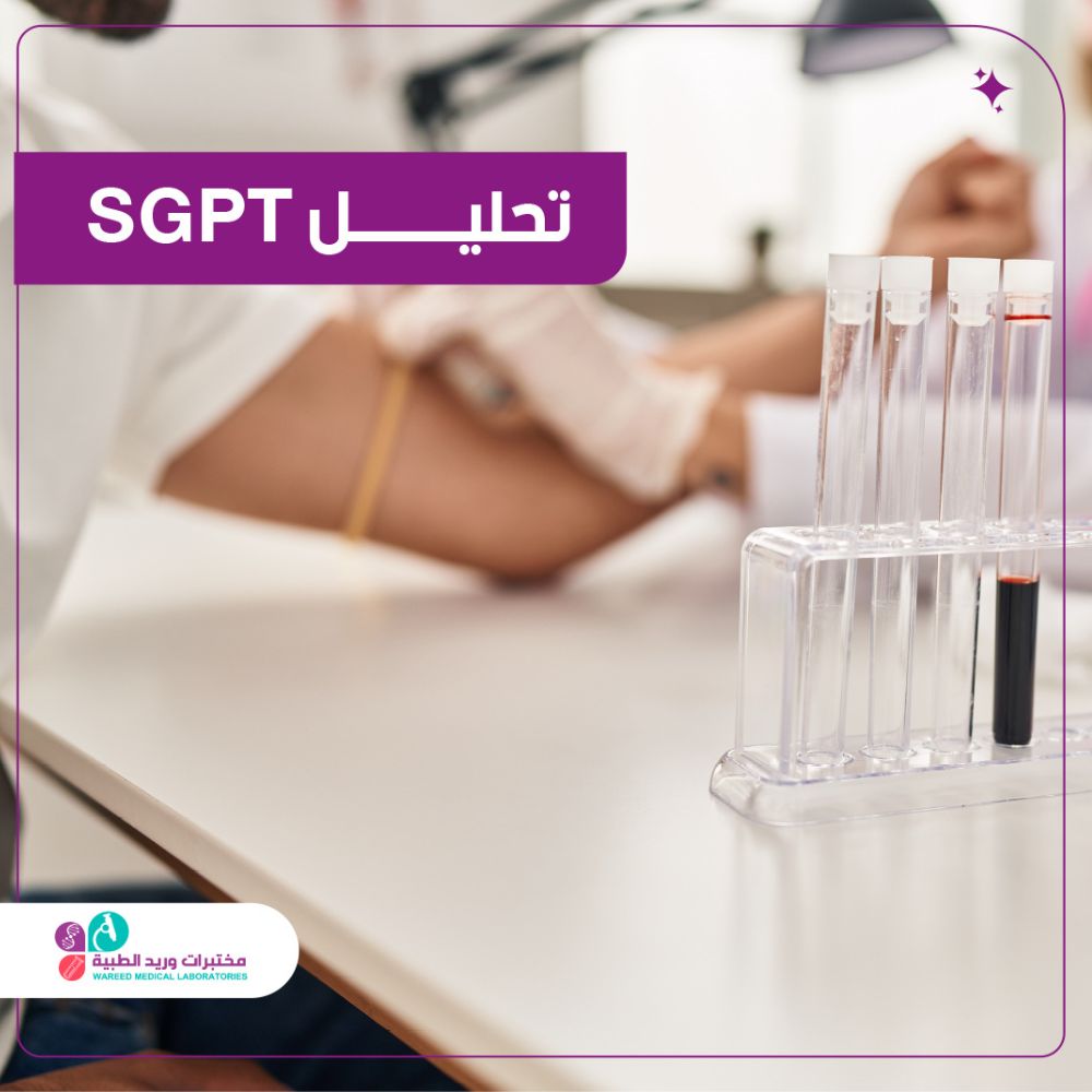 فهم تحليل SGPT وأهميته الصحية