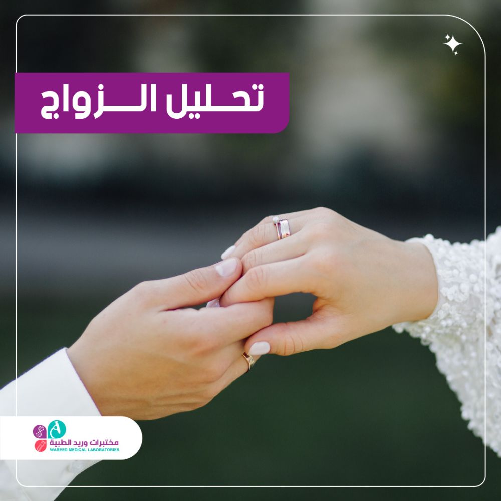 تحليل الزواج في العلاقات الزوجية
