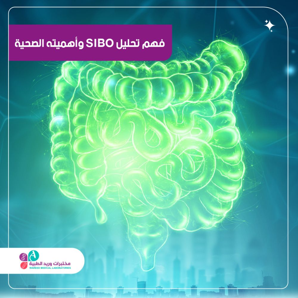 فهم تحليل SIBO وأهميته الصحية