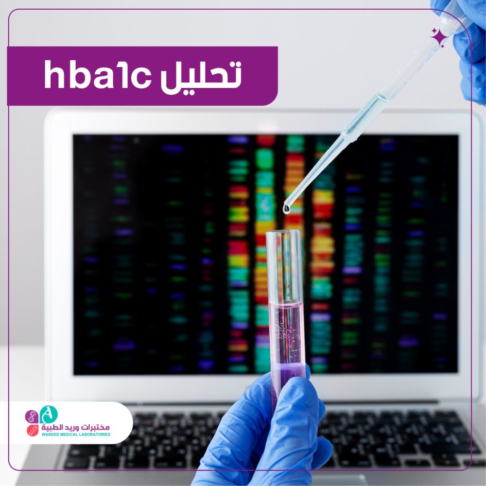 تحليل HbA1c