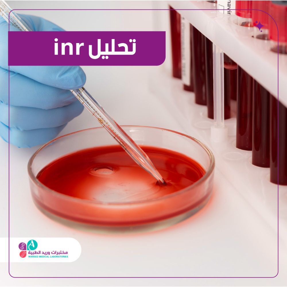 تحليل inr