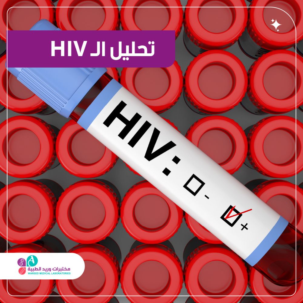 أهمية تحليل HIV في الرعاية الصحية