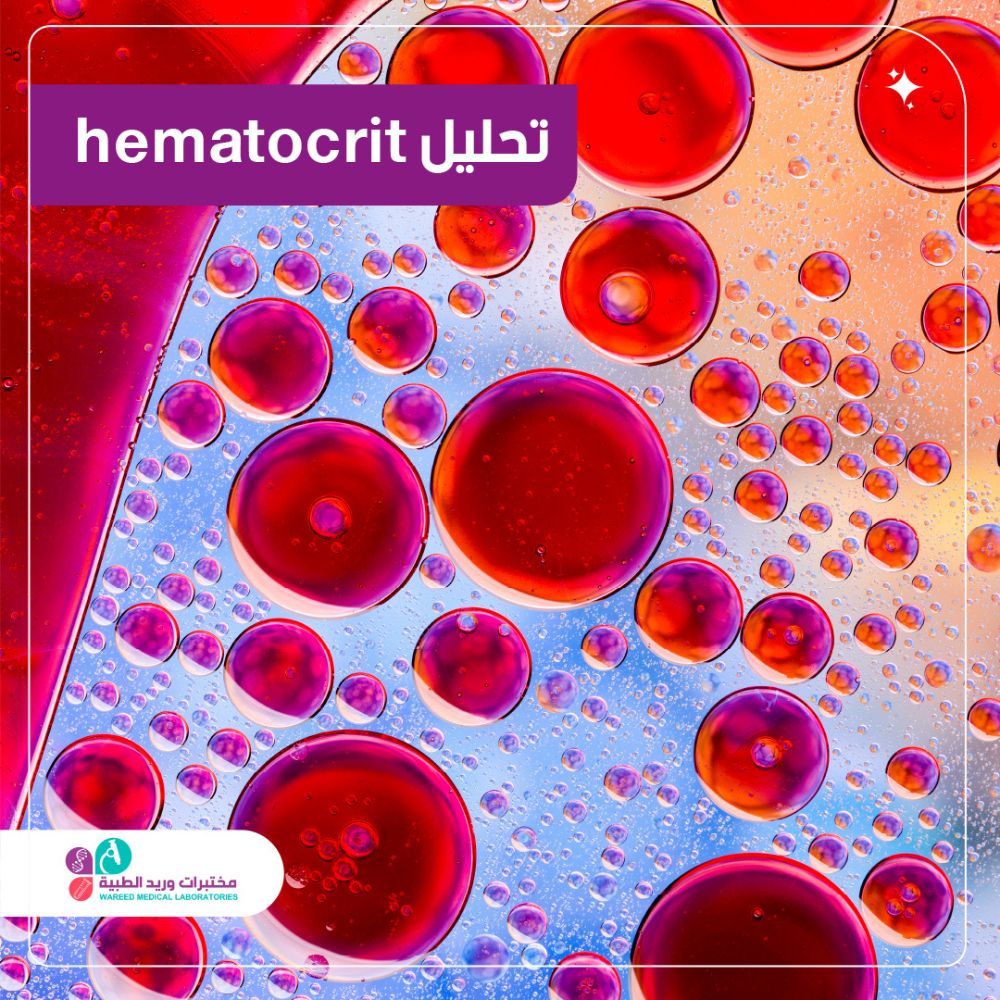 تحليل Hematocrit