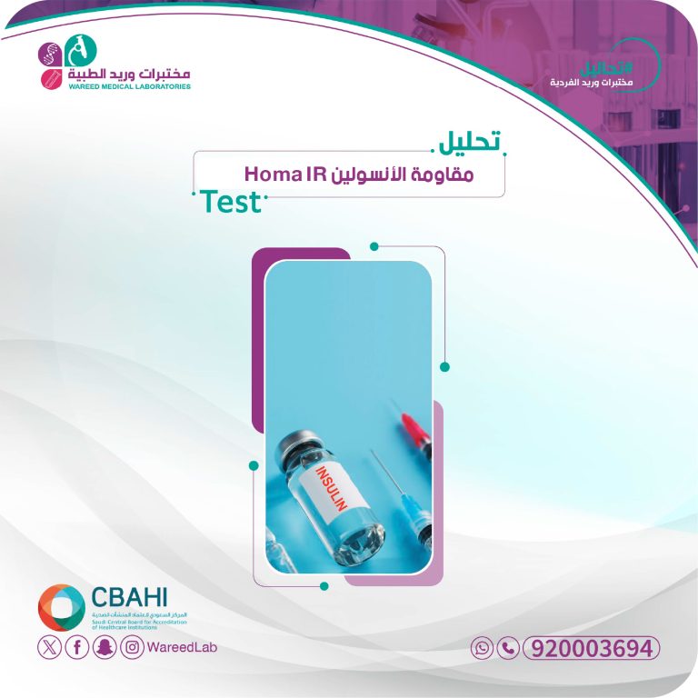 مقاومة الإنسولين