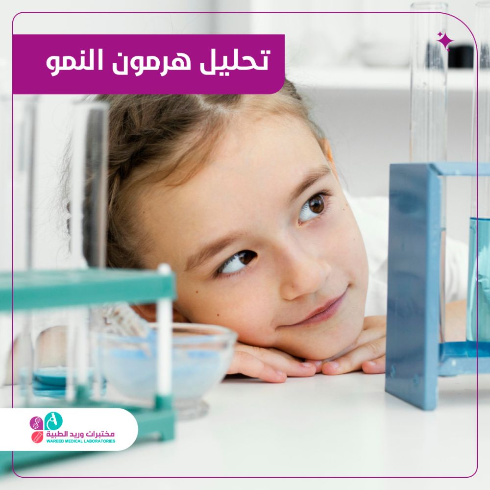 أهمية تحليل هرمون النمو في الصحة