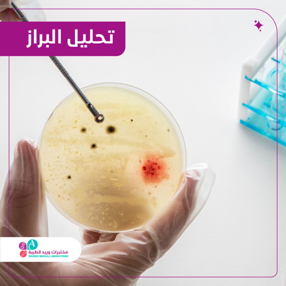 أهمية تحليل البراز في تشخيص الأمراض