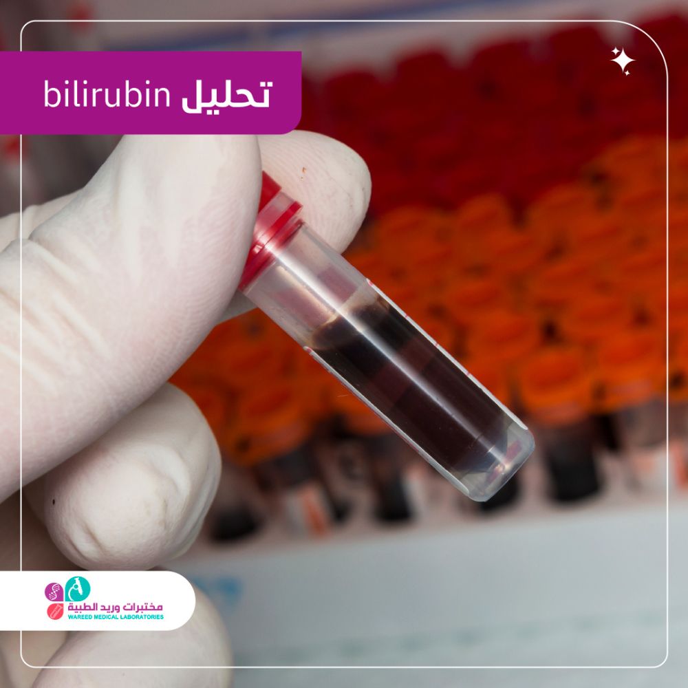 تحليل bilirubin