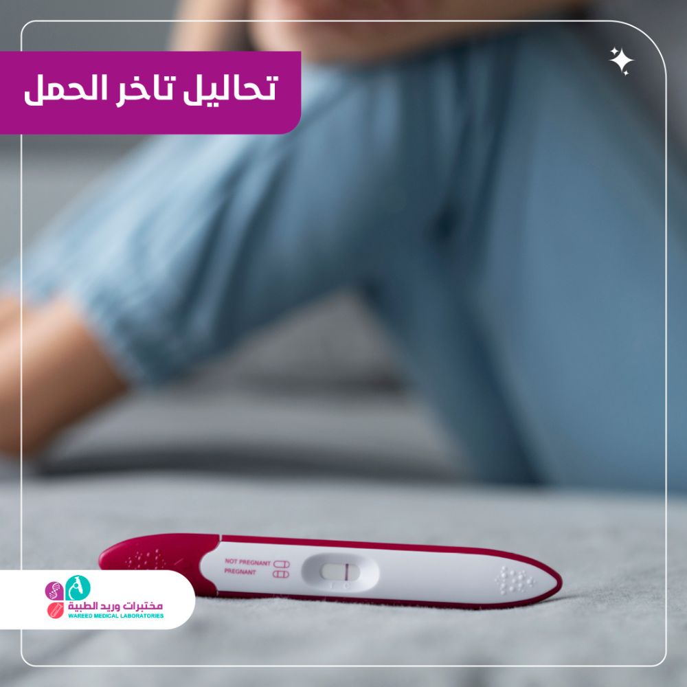 أسباب وتأثيرات تأخر الحمل والتحاليل اللازمة