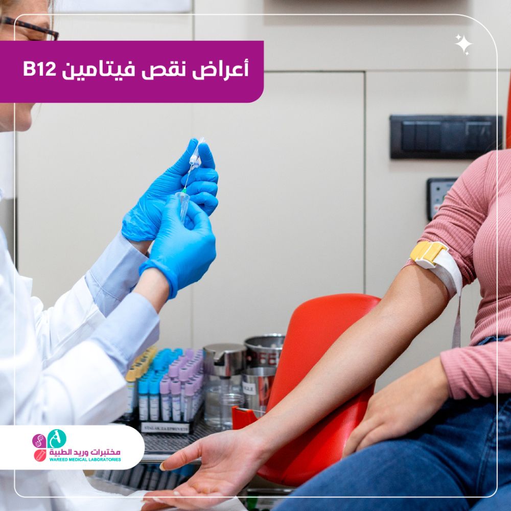 أعراض نقص فيتامين B12 وكيفية التعرف عليها