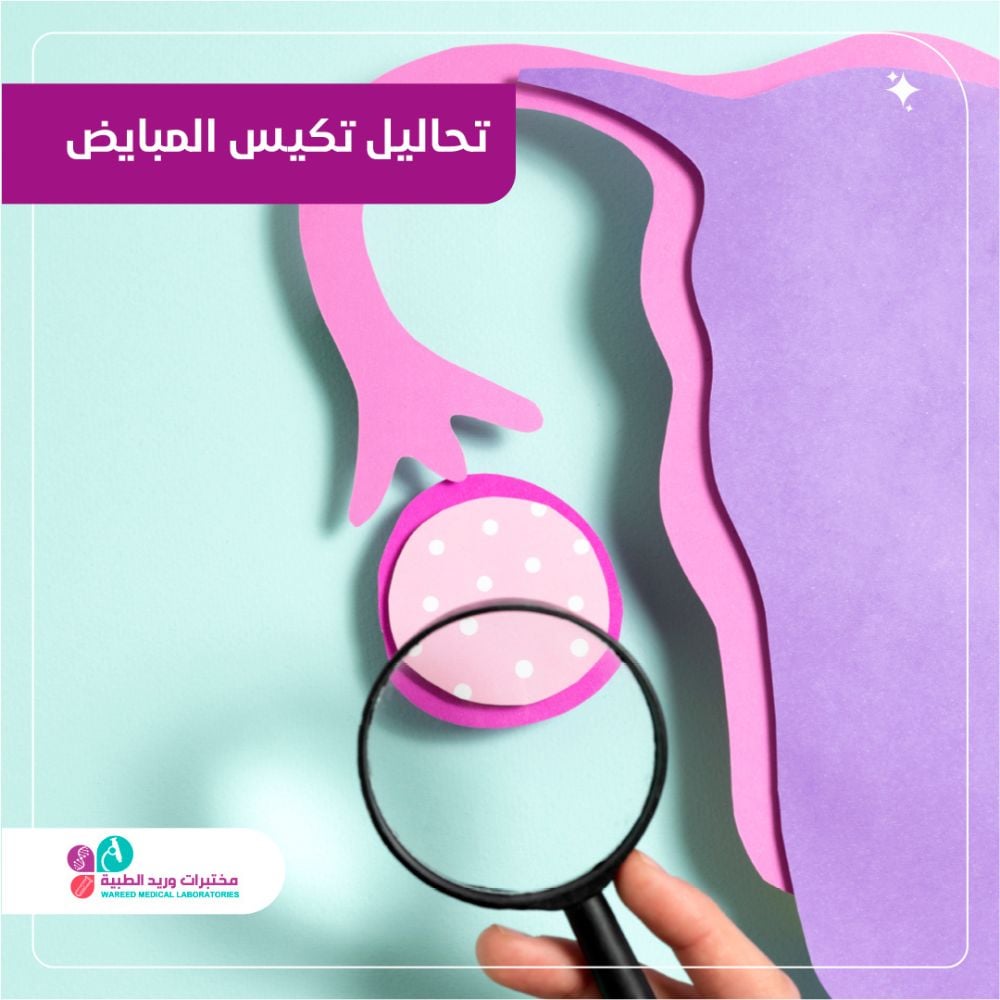 أهمية تحاليل تكيس المبايض في التشخيص