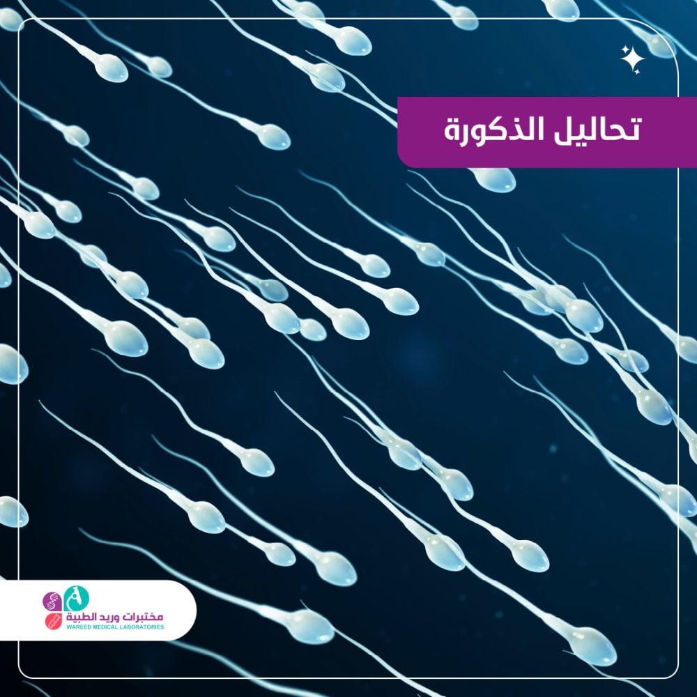 أهمية تحاليل الذكورة في الصحة العامة