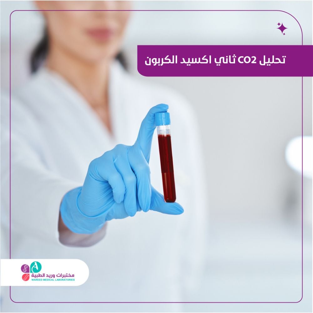 فحص مستوى co2 في الدم وتفسير نتائجه