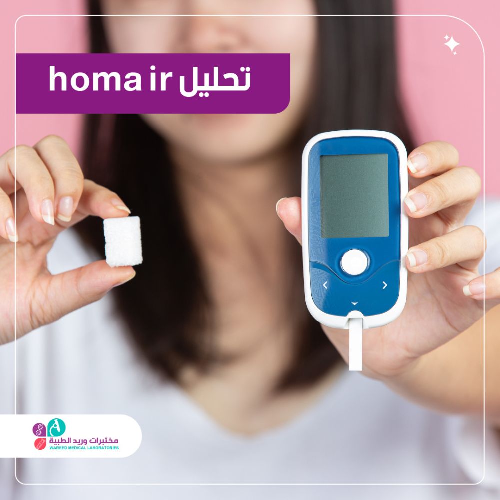 فهم تحليل HOMA-IR وأهميته الصحية