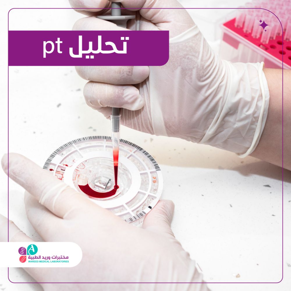 فهم تحليل PT وأهميته في الطب