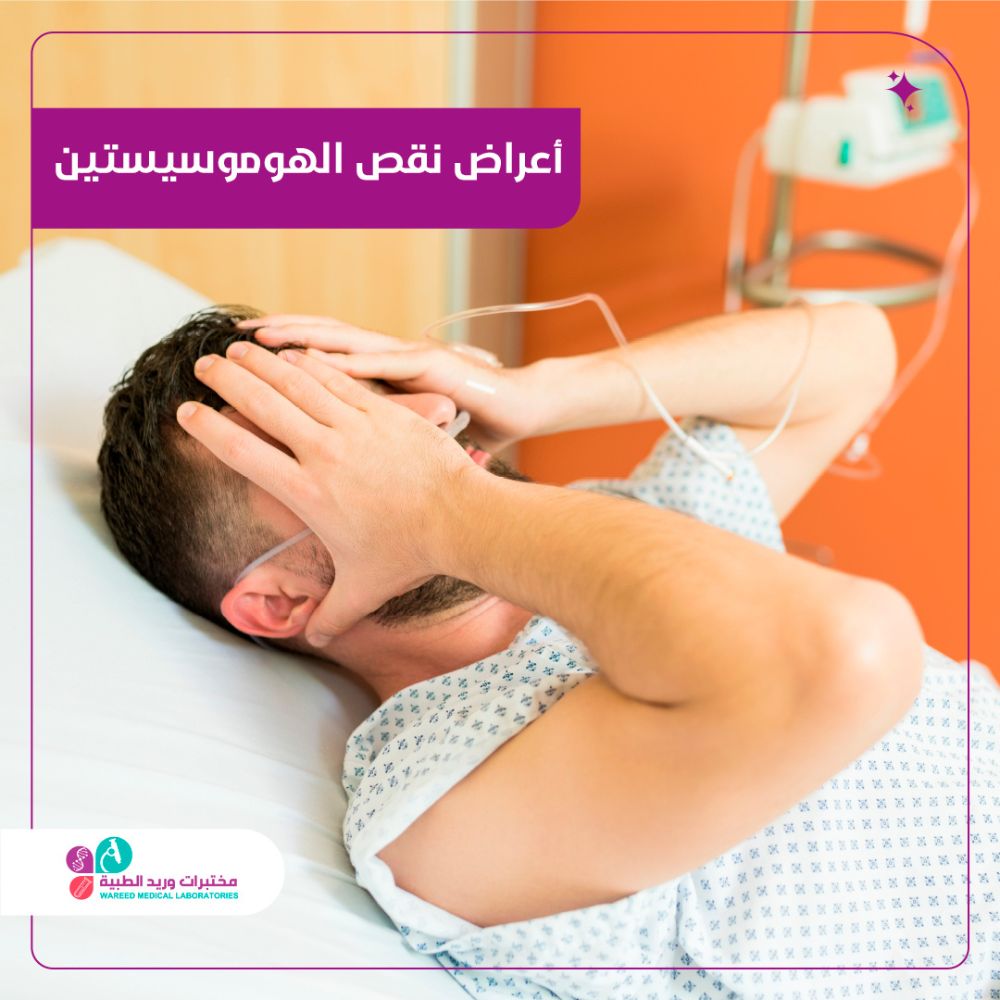 أعراض نقص الهوموسيستين