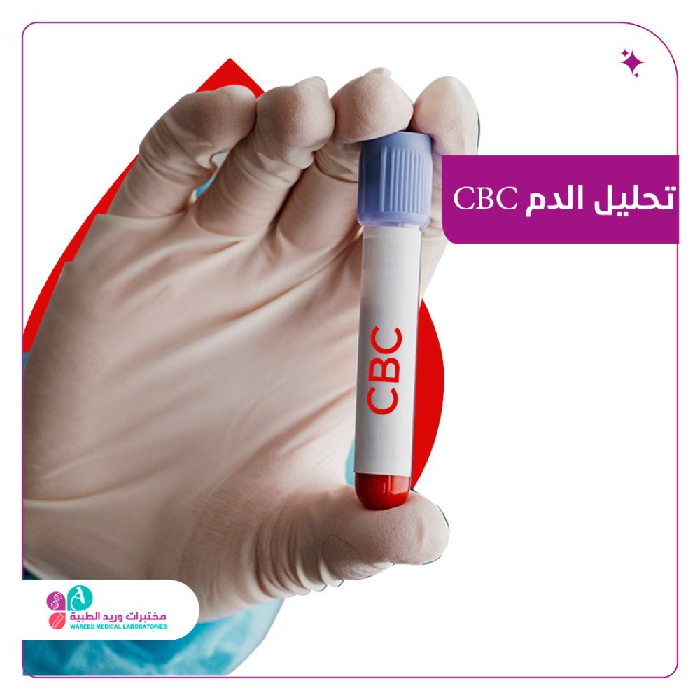 فهم تحليل الدم CBC وأهميته الصحية