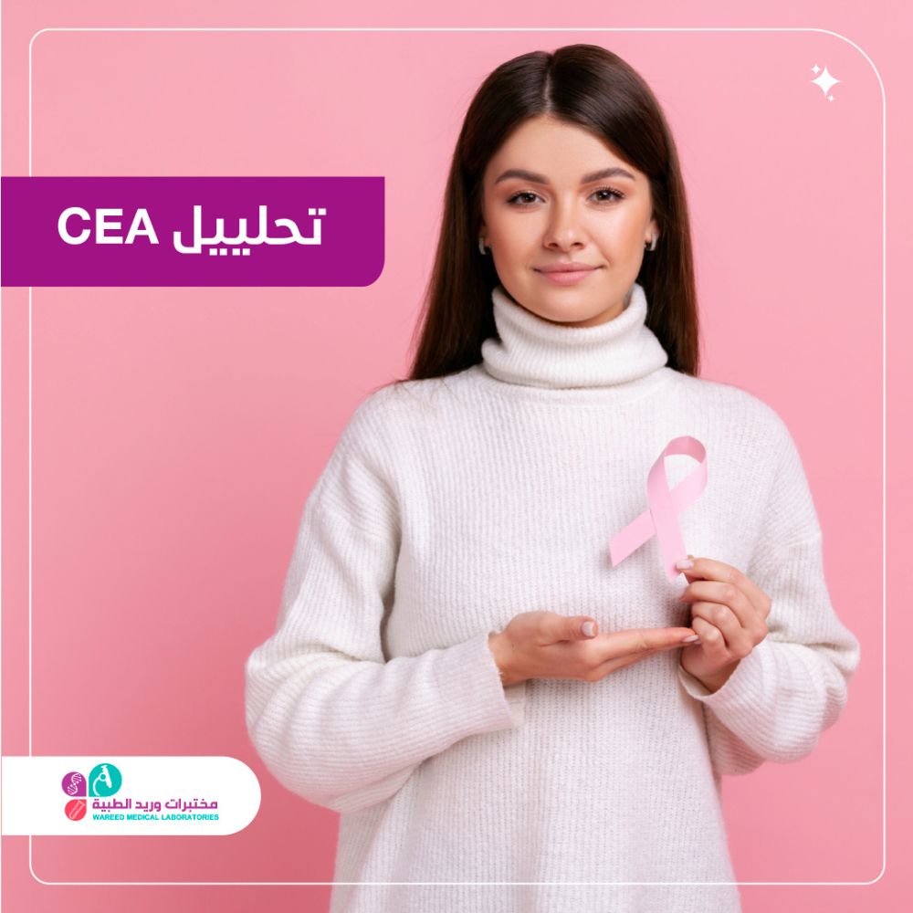 فهم تحليل CEA وأهميته في