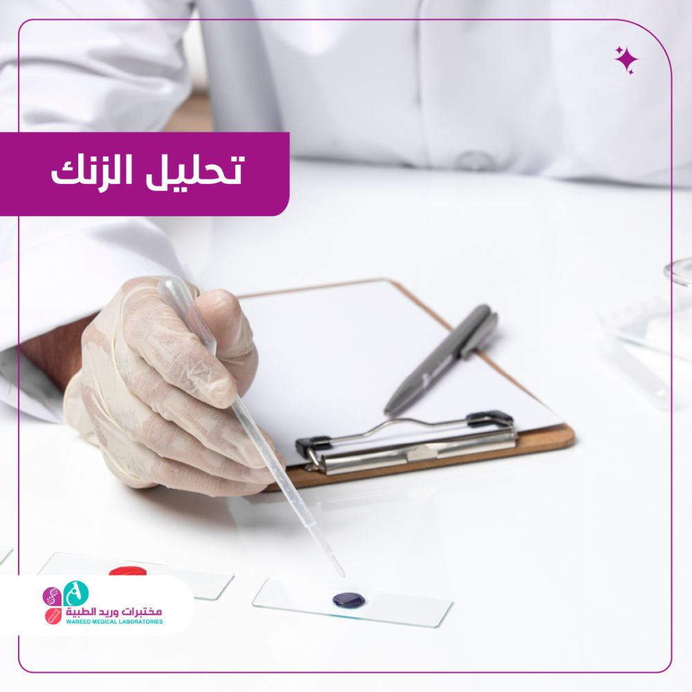 تحليل الزنك