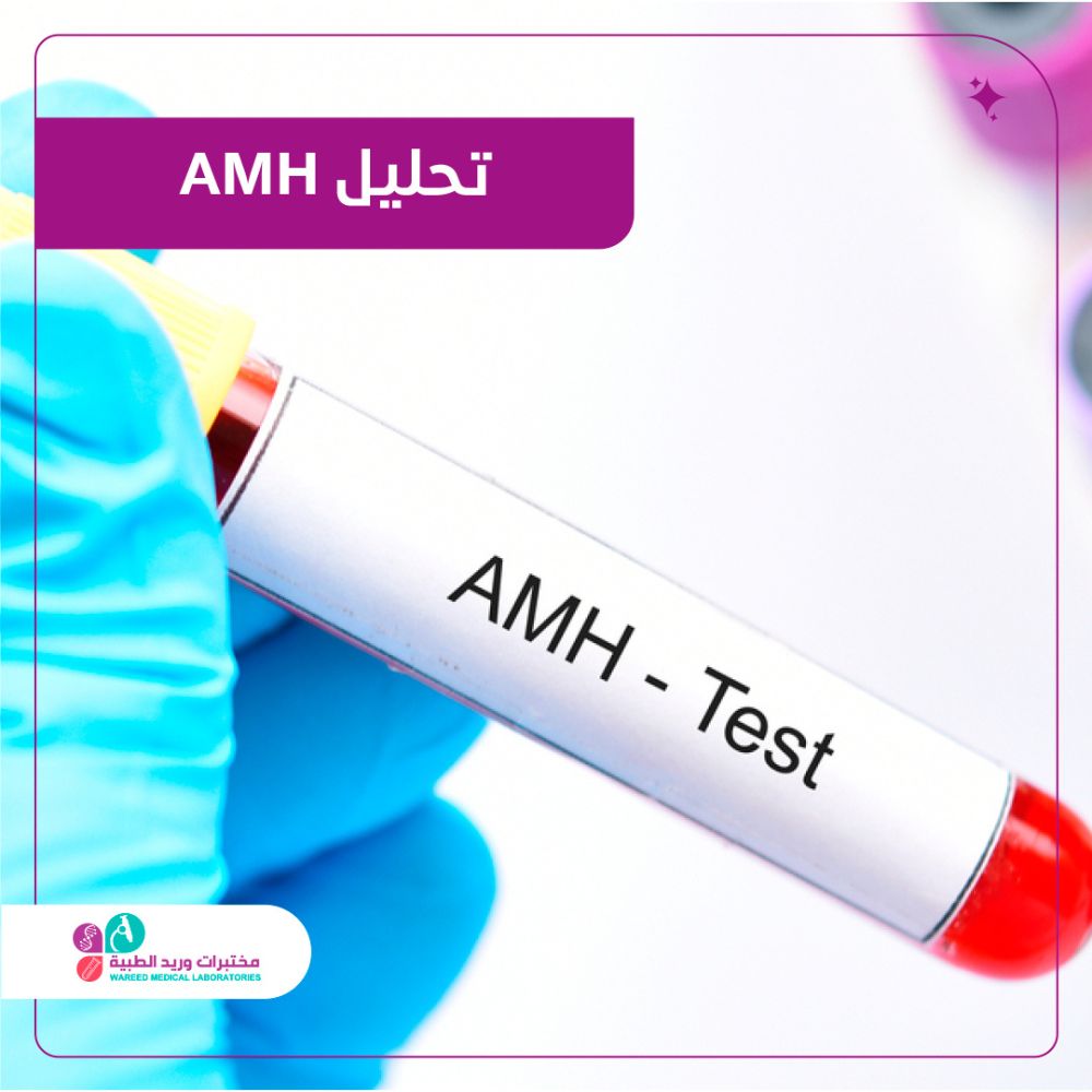 تحليل AMH