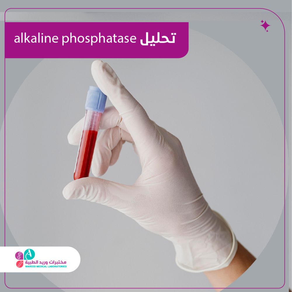 تحليل Alkaline Phosphatase