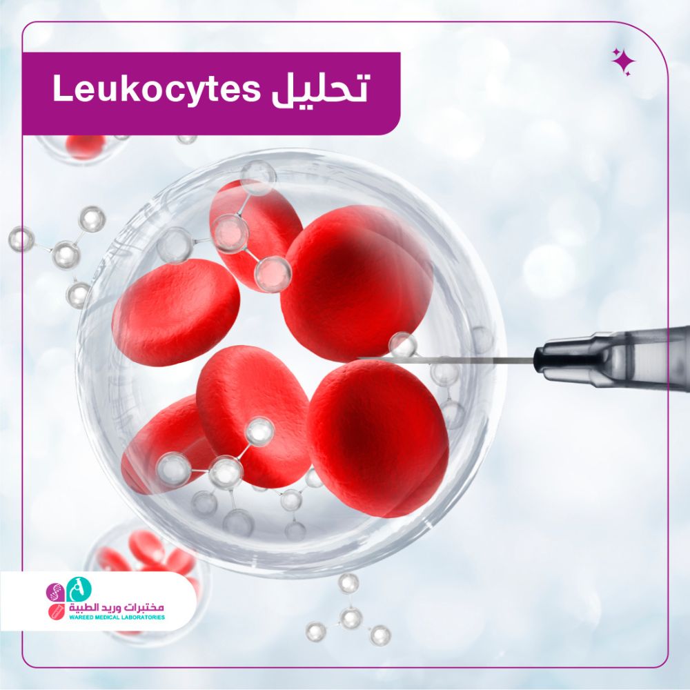 تحليل كريات الدم البيضاء