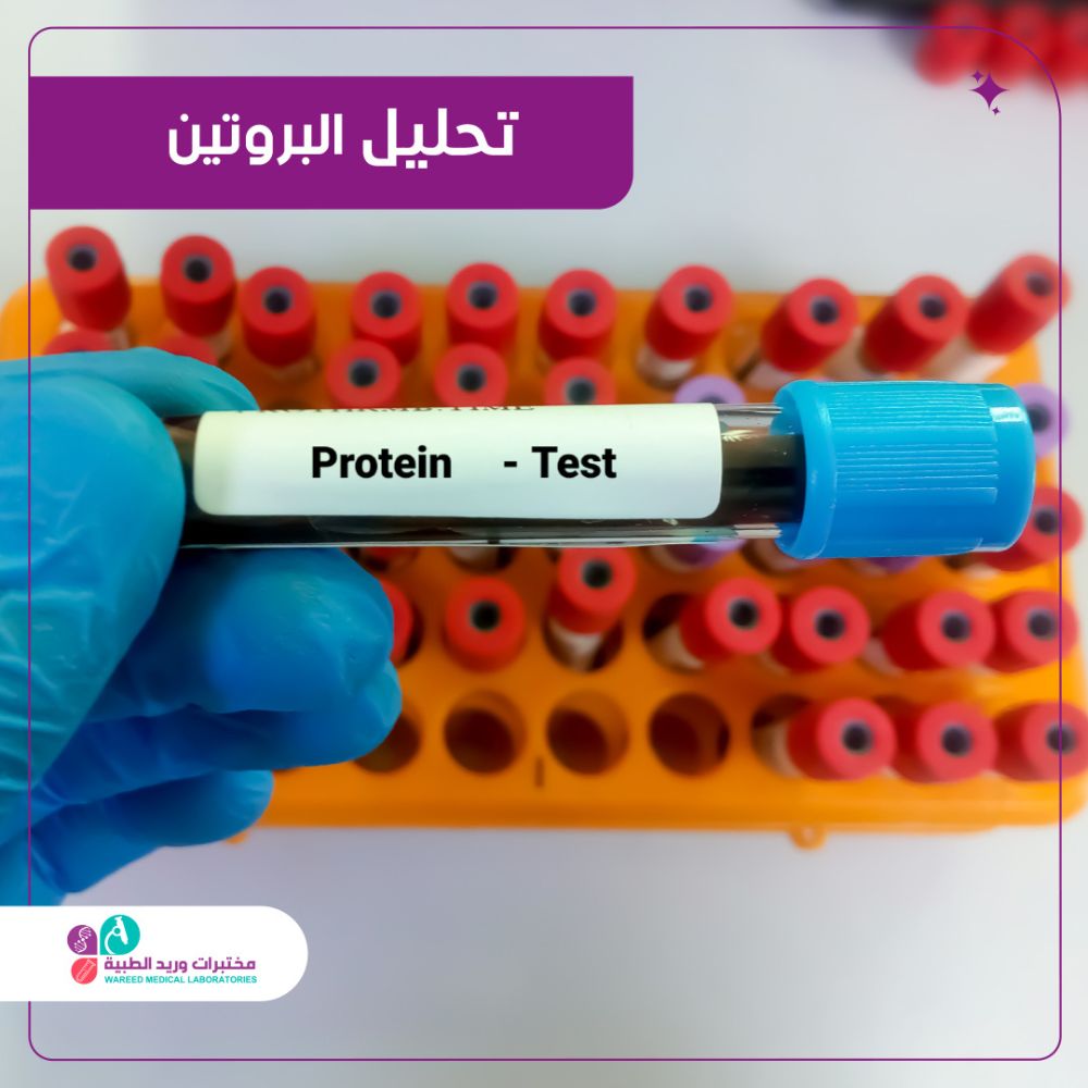 أهمية تحليل البروتين