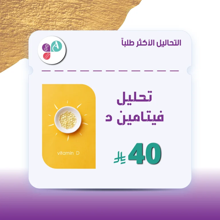 تحليل فيتامين د