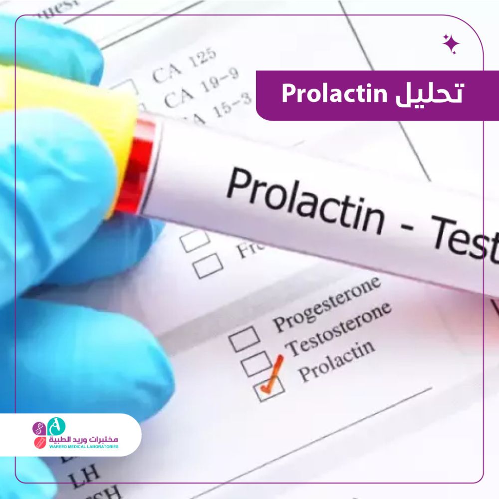 فهم تحليل Prolactin وأهميته الصحية