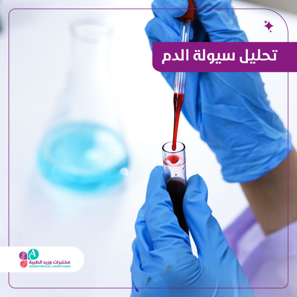 أهمية تحليل سيولة الدم في التشخيص
