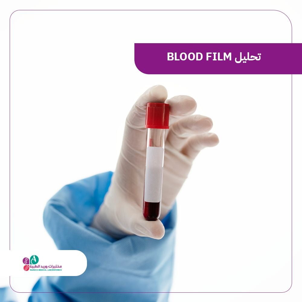 تحليل blood film