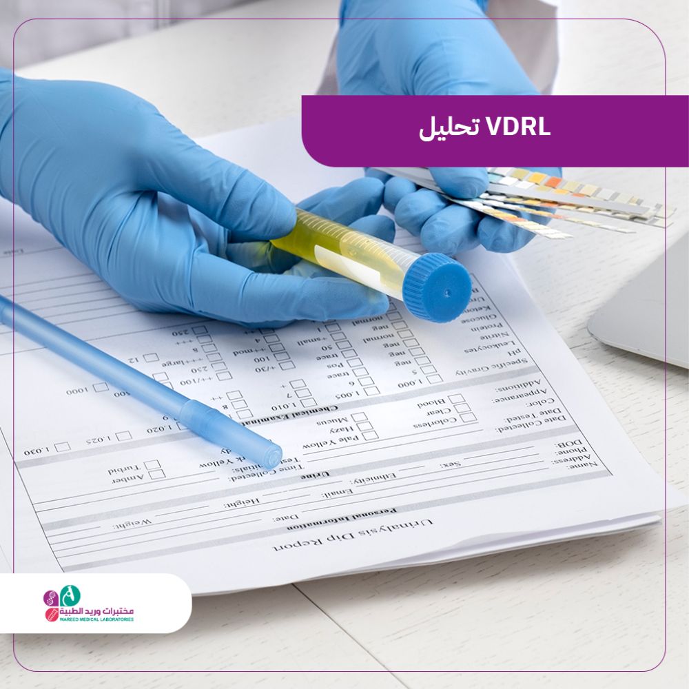 فهم تحليل VDRL وأهميته في الطب
