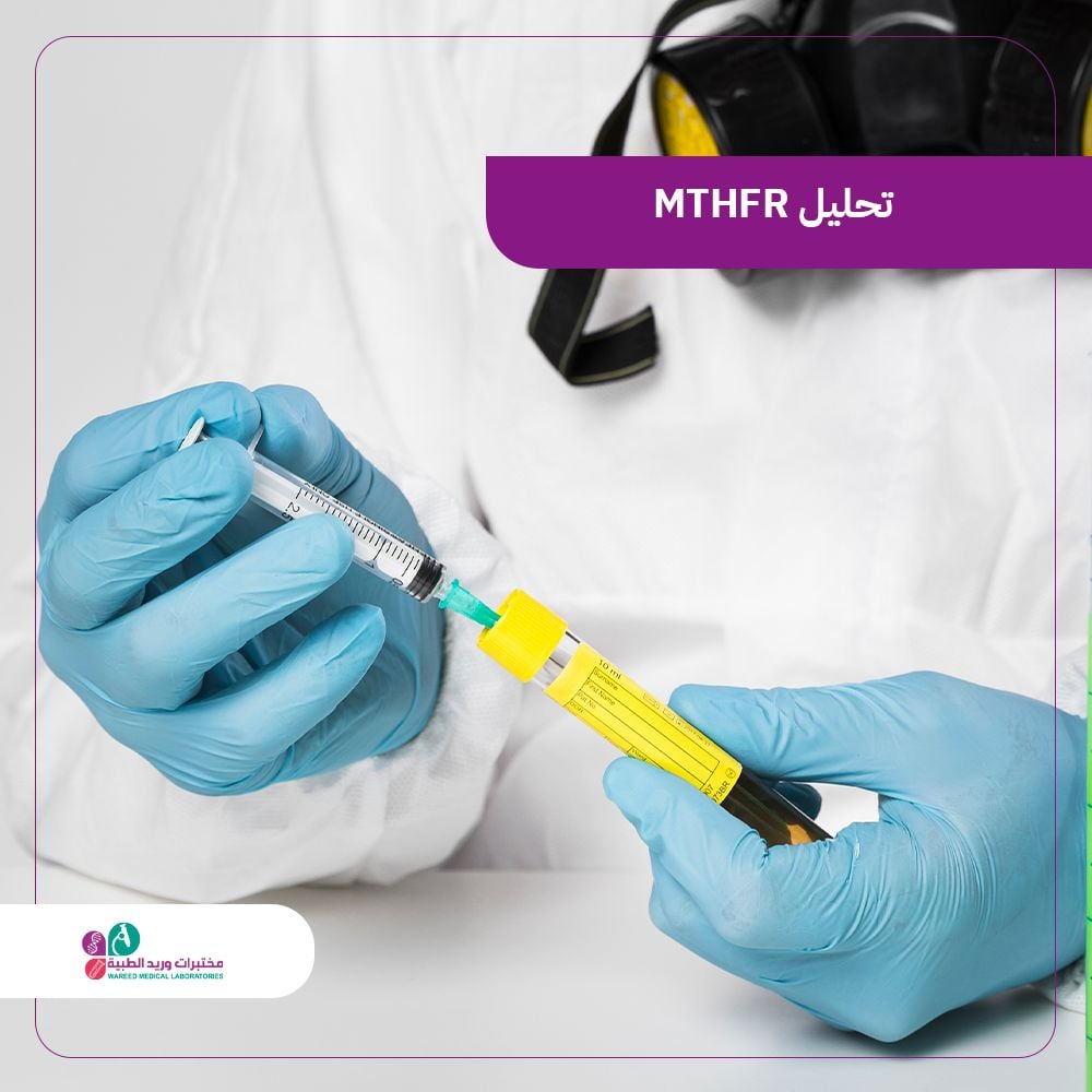 فهم تحليل MTHFR وأهميته الصحية