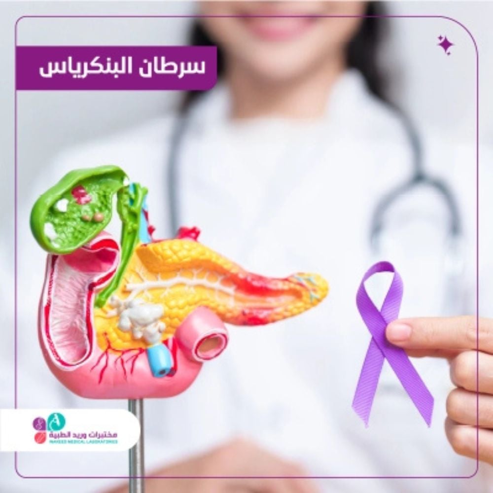 سرطان البنكرياس