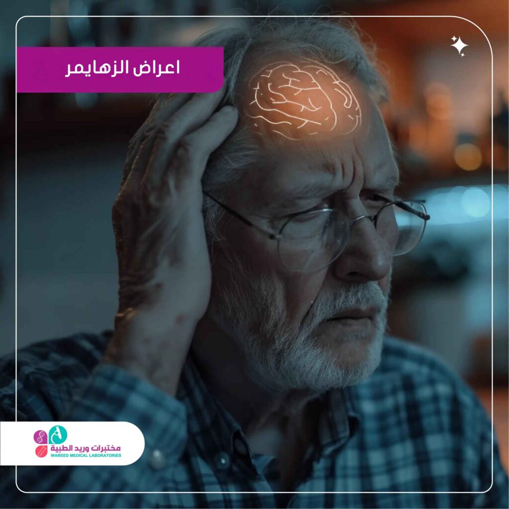 علامات الزهايمر المبكر وكيفية التعرف عليها