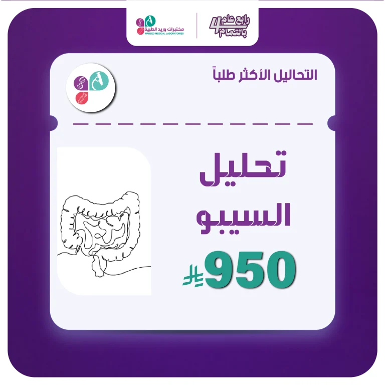 السيبو