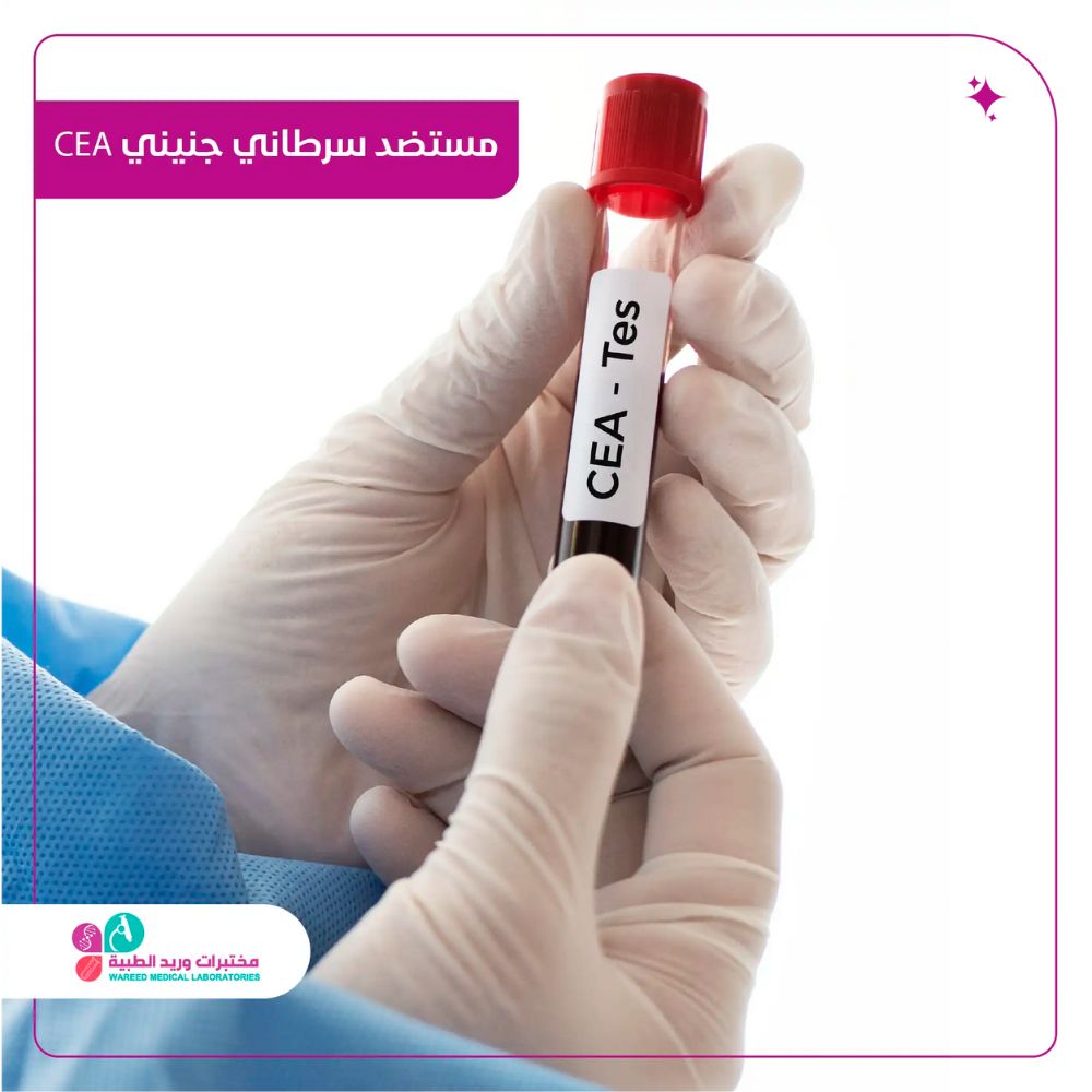 مستضد سرطاني جنيني cea
