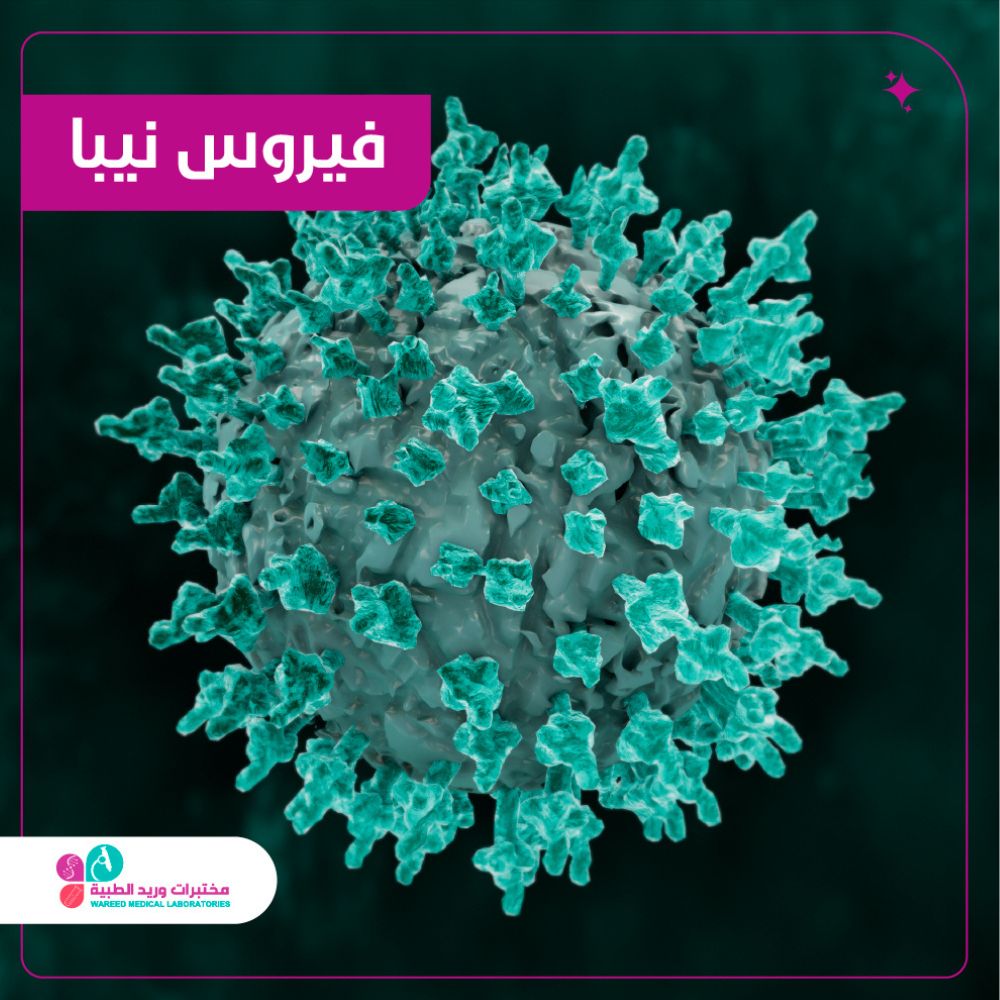 فيروس نيبا (Nipah Virus)