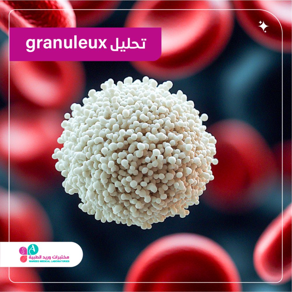 تحليل Granuleux (Gran)