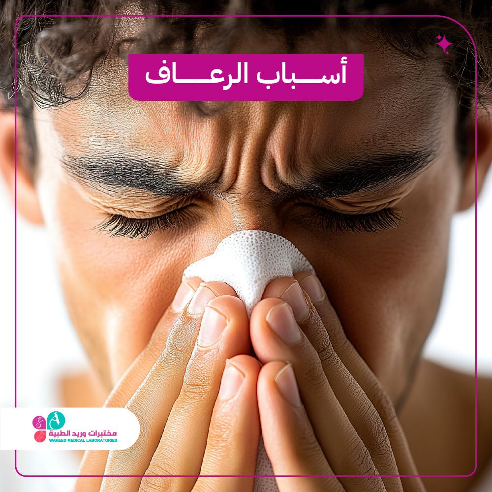 أسباب الرعاف