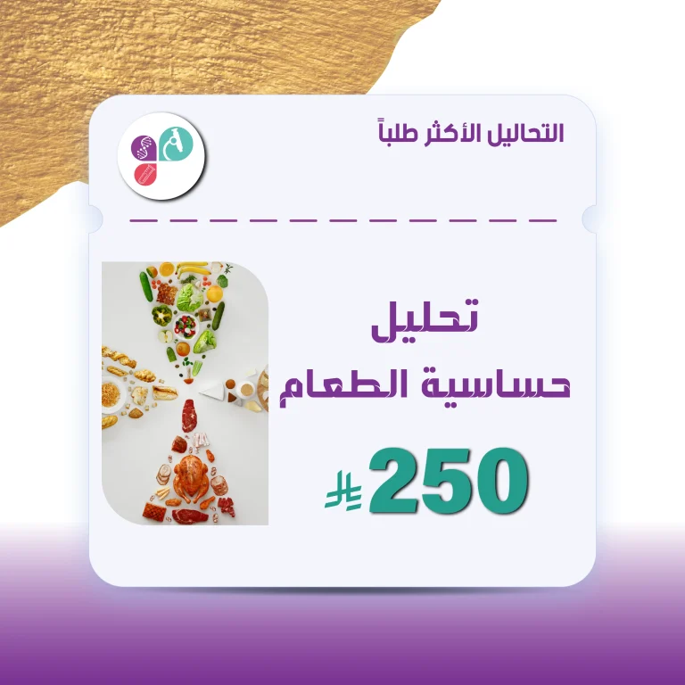 تحليل حساسية الطعام