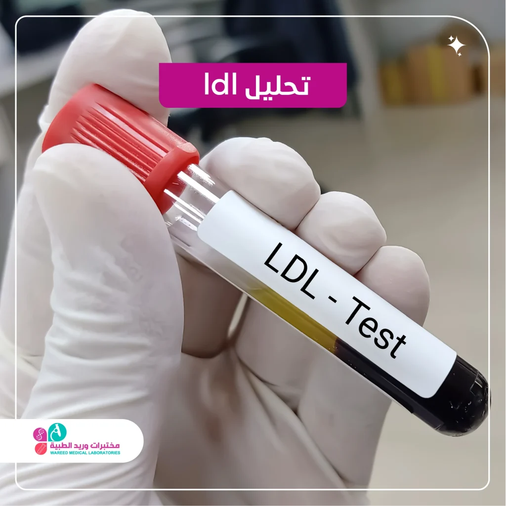ldl تحليل