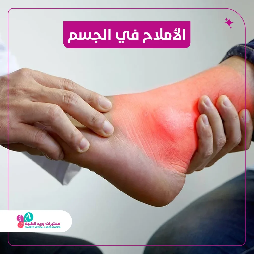 الأملاح في الجسم